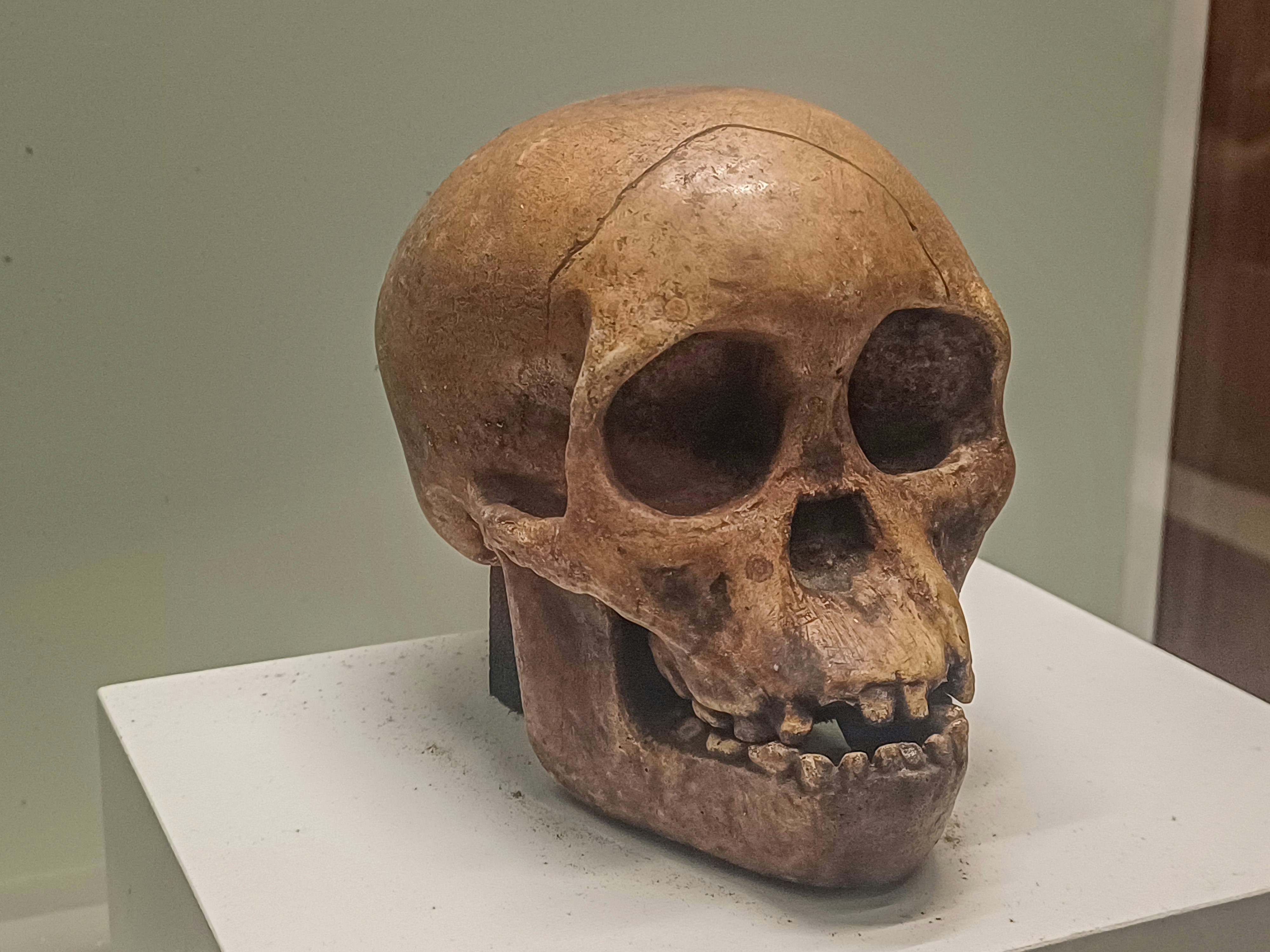 How Jaw Development Impacts Breathing, Sleep, and Appearance
