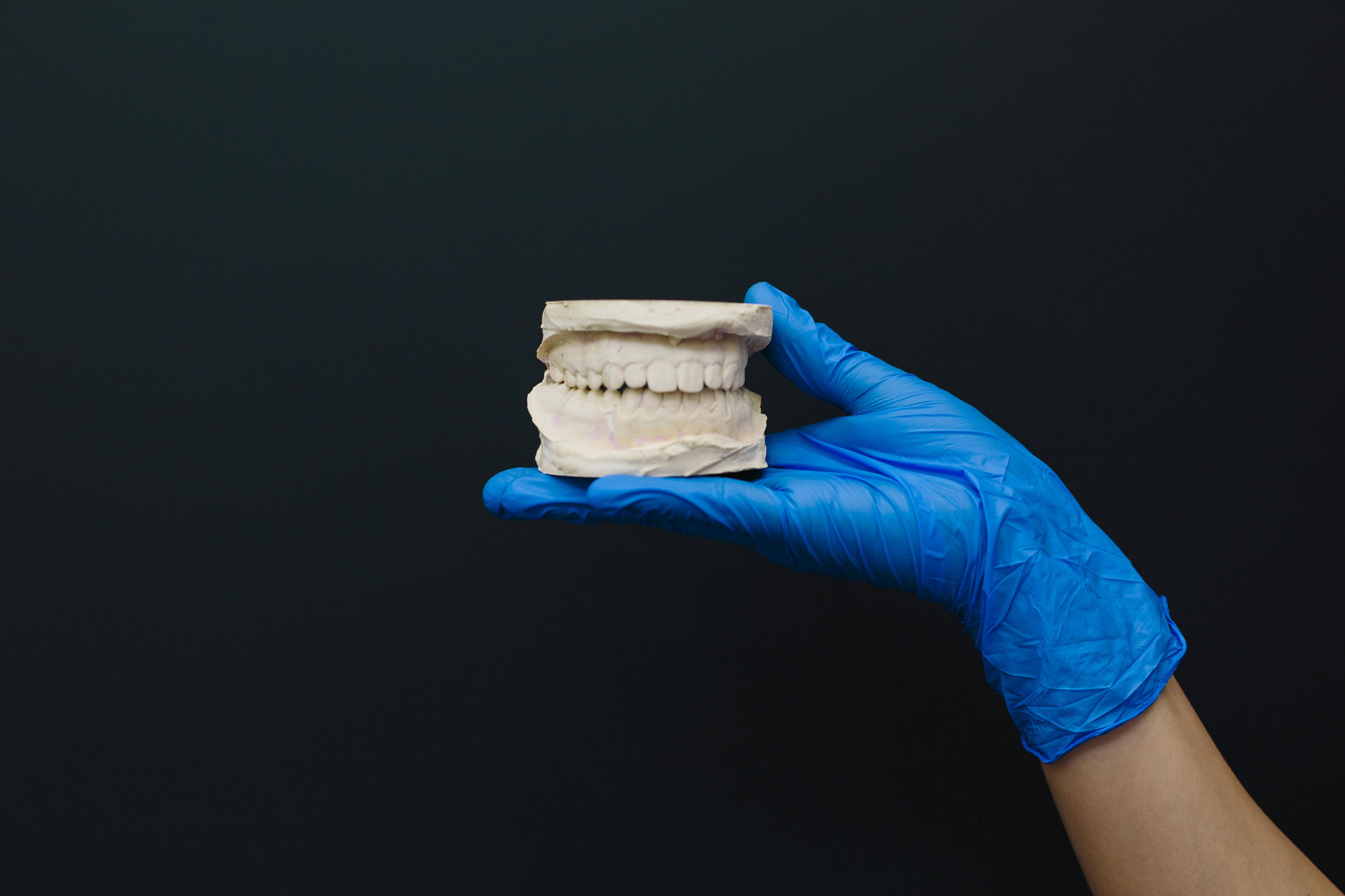 Palatal Expansion Explained: Benefits for Adults and Children
